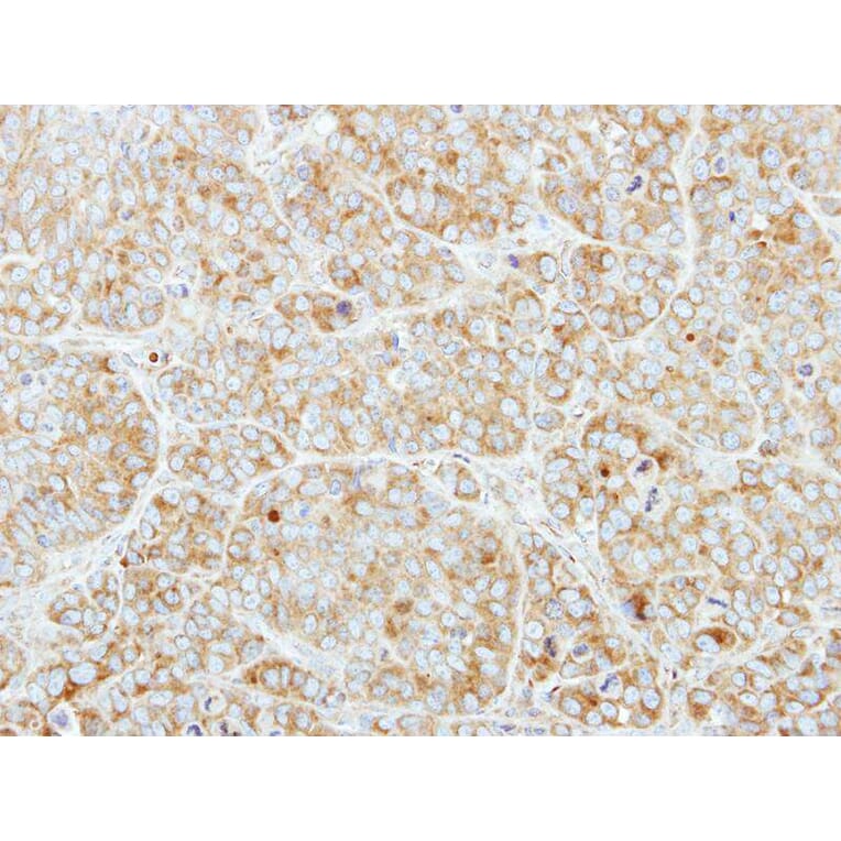 Immunohistochemistry - CSDE1 antibody from Signalway Antibody (22089) - Antibodies.com