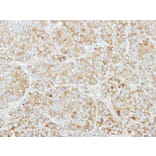 Immunohistochemistry - CSDE1 antibody from Signalway Antibody (22089) - Antibodies.com