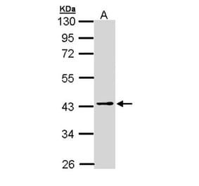 PSAT1 antibody from Signalway Antibody (22101) - Antibodies.com