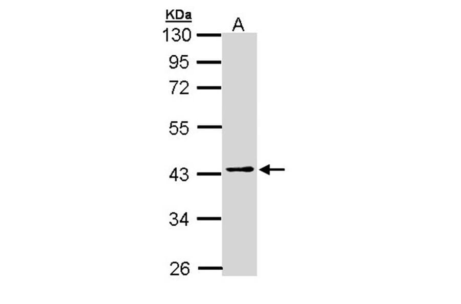 PSAT1 antibody from Signalway Antibody (22101) - Antibodies.com