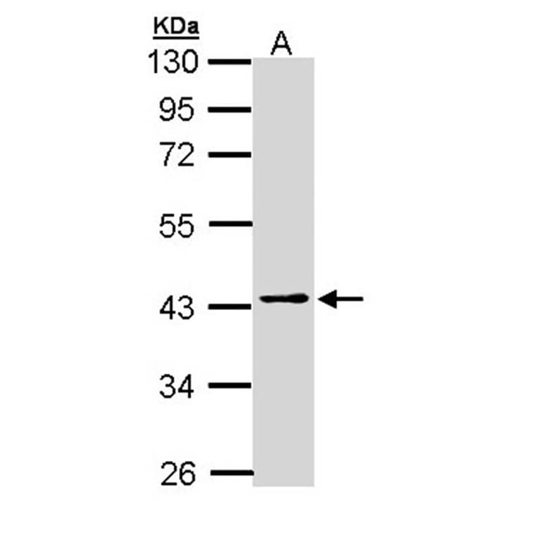 PSAT1 antibody from Signalway Antibody (22101) - Antibodies.com