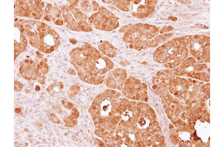 Immunohistochemistry - PSAT1 antibody from Signalway Antibody (22101) - Antibodies.com