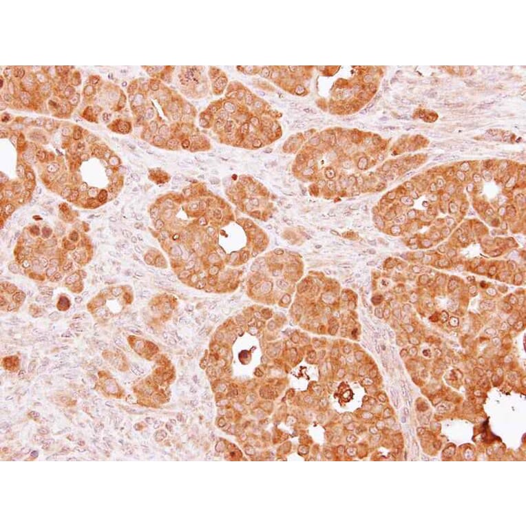 Immunohistochemistry - PSAT1 antibody from Signalway Antibody (22101) - Antibodies.com