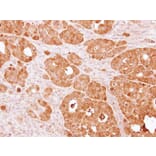 Immunohistochemistry - PSAT1 antibody from Signalway Antibody (22101) - Antibodies.com