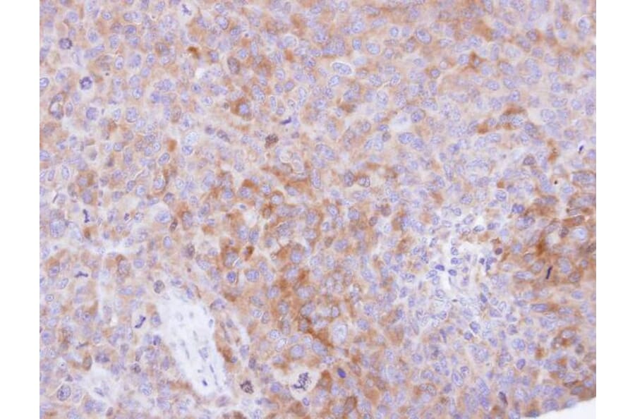 Immunohistochemistry - CKAP1 antibody from Signalway Antibody (22154) - Antibodies.com