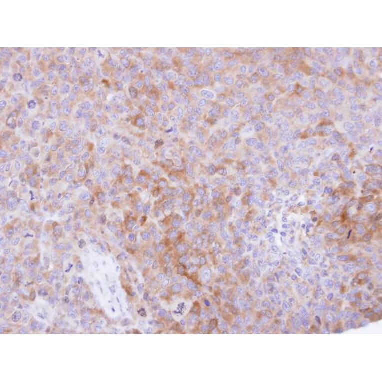Immunohistochemistry - CKAP1 antibody from Signalway Antibody (22154) - Antibodies.com