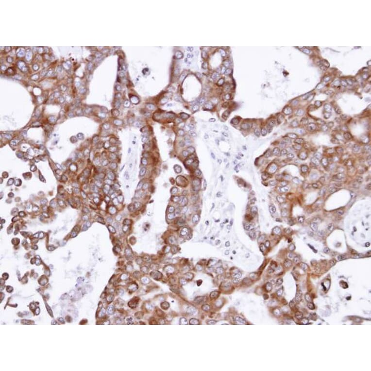 Immunohistochemistry - PANK1 antibody from Signalway Antibody (22172) - Antibodies.com