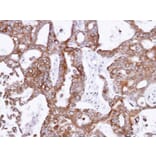 Immunohistochemistry - PANK1 antibody from Signalway Antibody (22172) - Antibodies.com