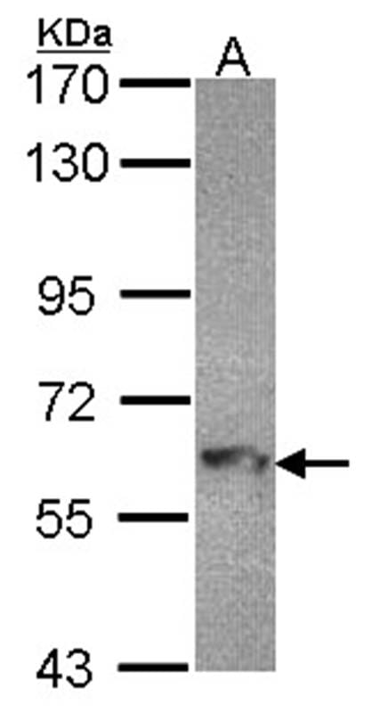 Sample (30 µg of whole cell lysate)  Hep G2 7.5% SDS PAGE MTMR9 antibody diluted at 1: 1000