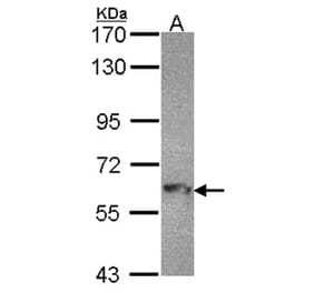 MTMR9 antibody from Signalway Antibody (22220) - Antibodies.com