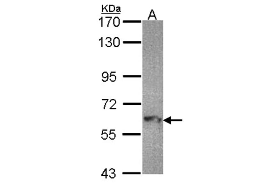 MTMR9 antibody from Signalway Antibody (22220) - Antibodies.com