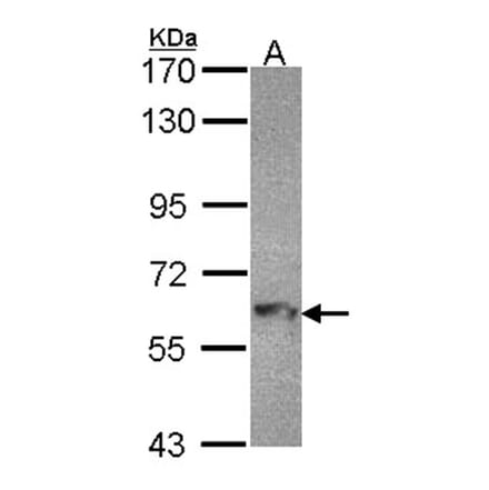 MTMR9 antibody from Signalway Antibody (22220) - Antibodies.com