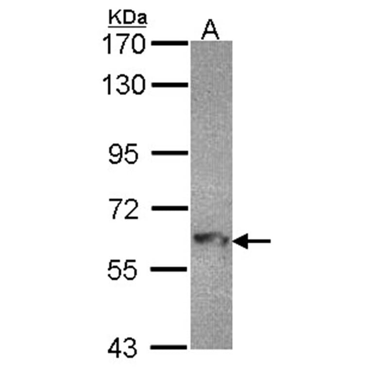 MTMR9 antibody from Signalway Antibody (22220) - Antibodies.com