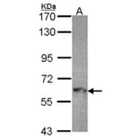 MTMR9 antibody from Signalway Antibody (22220) - Antibodies.com