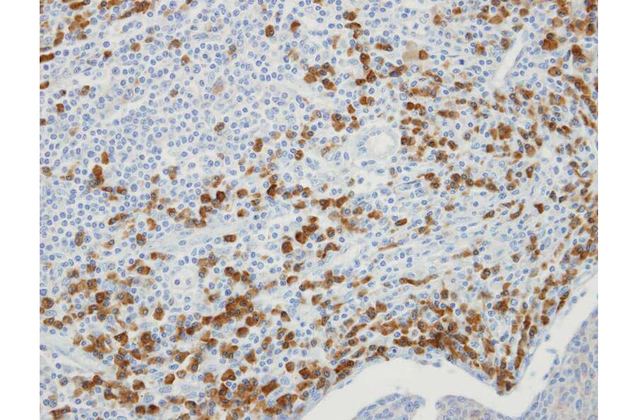 Immunohistochemistry - MTMR9 antibody from Signalway Antibody (22220) - Antibodies.com