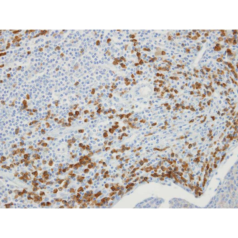 Immunohistochemistry - MTMR9 antibody from Signalway Antibody (22220) - Antibodies.com
