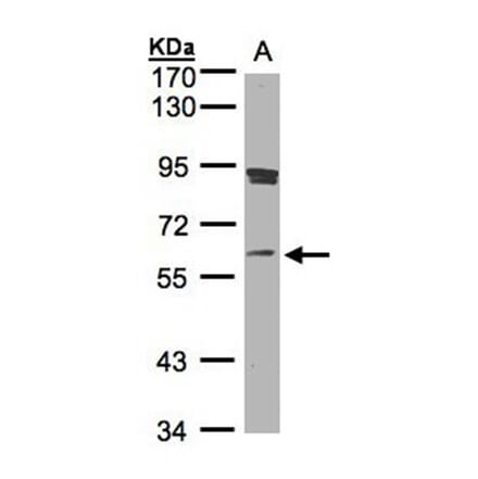 SCMH1 antibody from Signalway Antibody (22239) - Antibodies.com