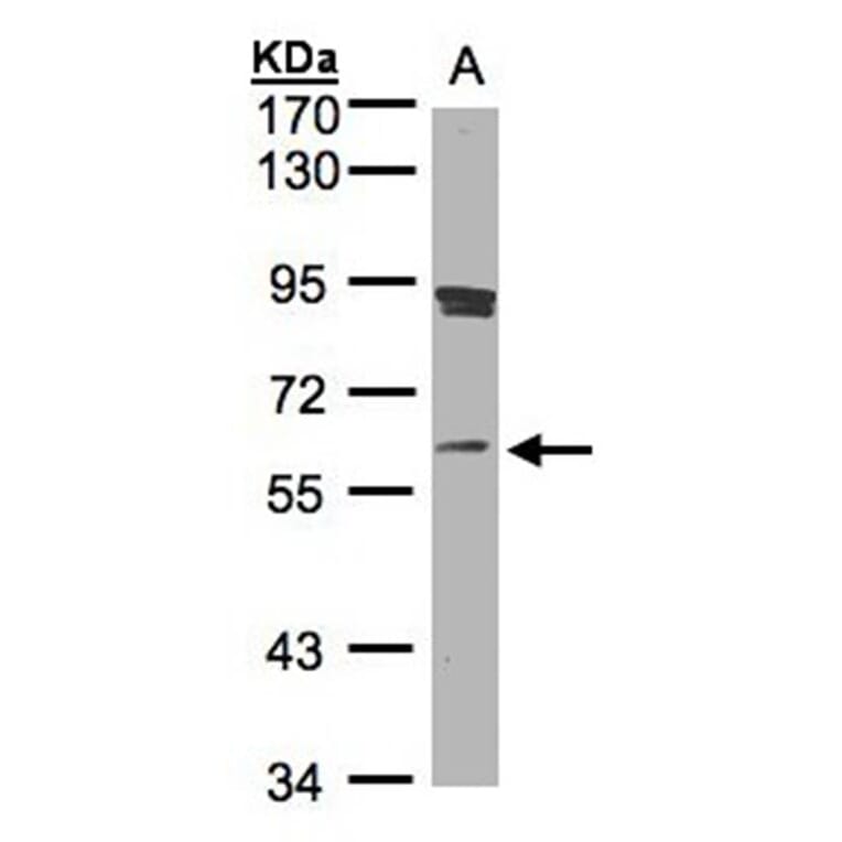 SCMH1 antibody from Signalway Antibody (22239) - Antibodies.com