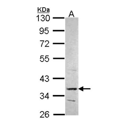 PRPS2 antibody from Signalway Antibody (22246) - Antibodies.com