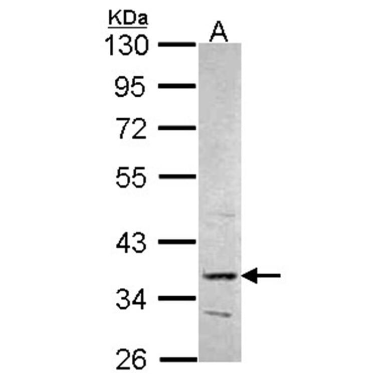 PRPS2 antibody from Signalway Antibody (22246) - Antibodies.com