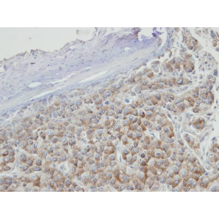 Immunohistochemistry - PRPS2 antibody from Signalway Antibody (22246) - Antibodies.com