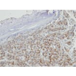 Immunohistochemistry - PRPS2 antibody from Signalway Antibody (22246) - Antibodies.com