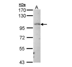 LARS2 antibody from Signalway Antibody (22247) - Antibodies.com