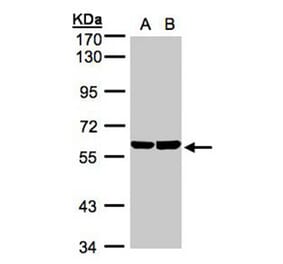 TBRG4 antibody from Signalway Antibody (22248) - Antibodies.com