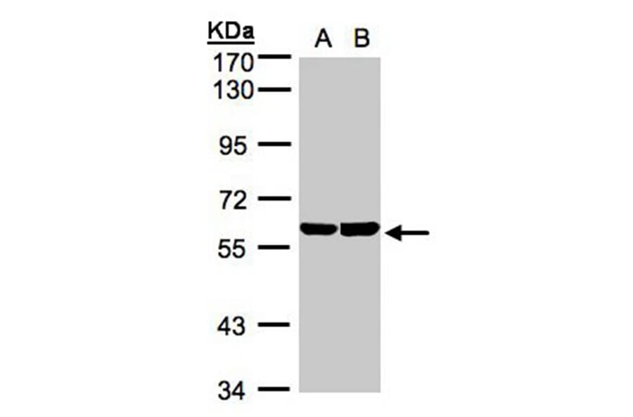 TBRG4 antibody from Signalway Antibody (22248) - Antibodies.com