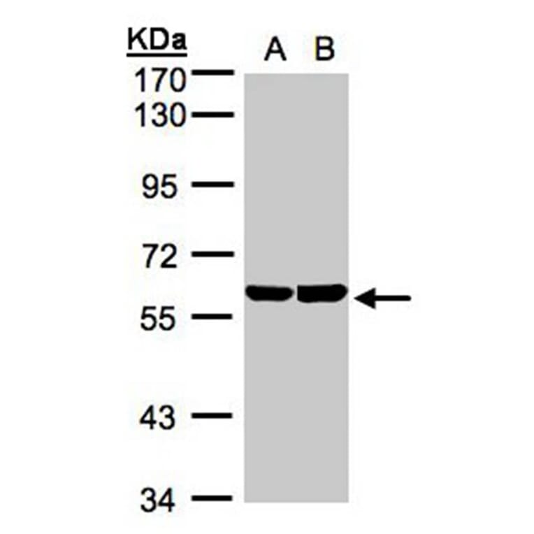 TBRG4 antibody from Signalway Antibody (22248) - Antibodies.com