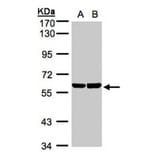 TBRG4 antibody from Signalway Antibody (22248) - Antibodies.com