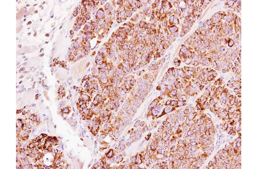 Immunohistochemistry - TBRG4 antibody from Signalway Antibody (22248) - Antibodies.com