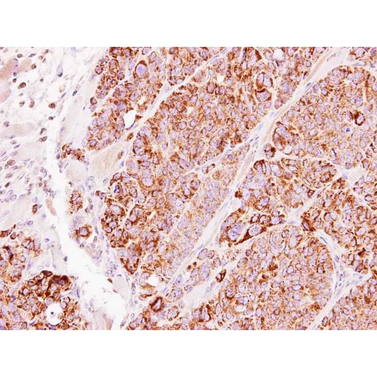 Immunohistochemistry - TBRG4 antibody from Signalway Antibody (22248) - Antibodies.com