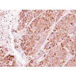 Immunohistochemistry - TBRG4 antibody from Signalway Antibody (22248) - Antibodies.com
