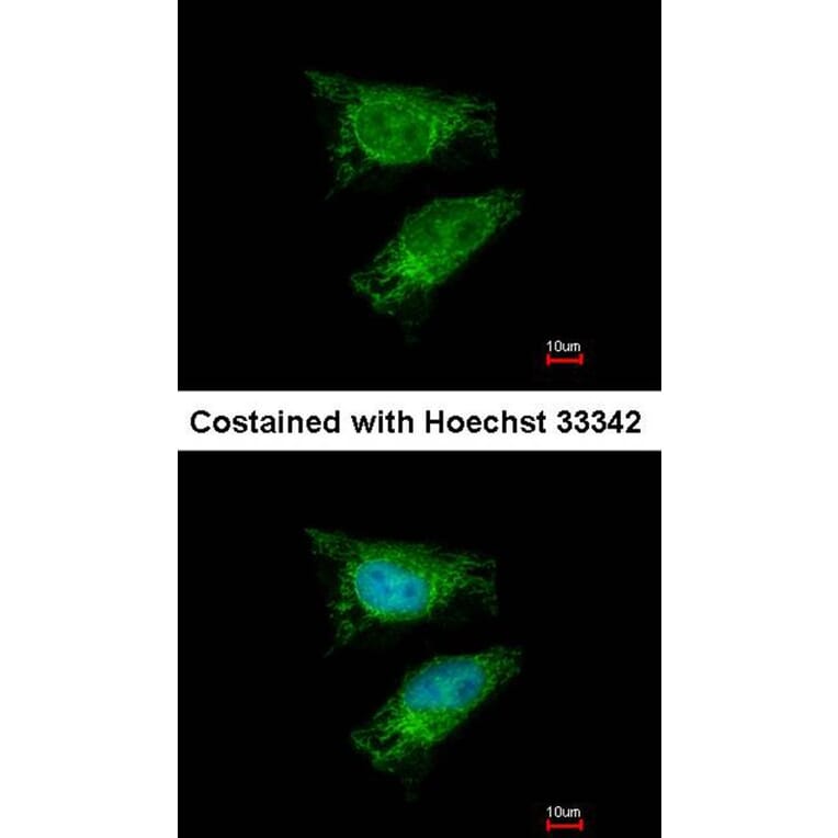 Immunofluorescence - TBRG4 antibody from Signalway Antibody (22248) - Antibodies.com