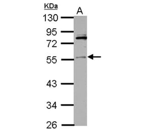 IP6K1 antibody from Signalway Antibody (22254) - Antibodies.com