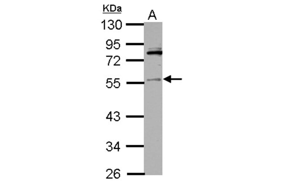 IP6K1 antibody from Signalway Antibody (22254) - Antibodies.com