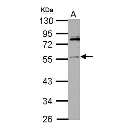 IP6K1 antibody from Signalway Antibody (22254) - Antibodies.com