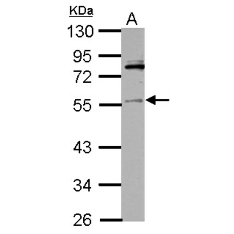 IP6K1 antibody from Signalway Antibody (22254) - Antibodies.com