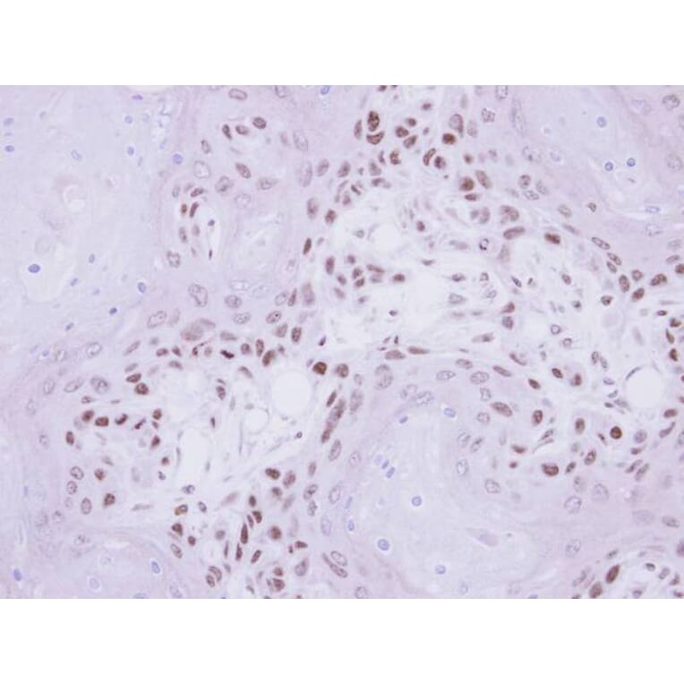 Immunohistochemistry - IP6K1 antibody from Signalway Antibody (22254) - Antibodies.com