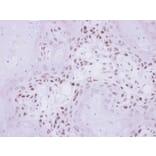 Immunohistochemistry - IP6K1 antibody from Signalway Antibody (22254) - Antibodies.com