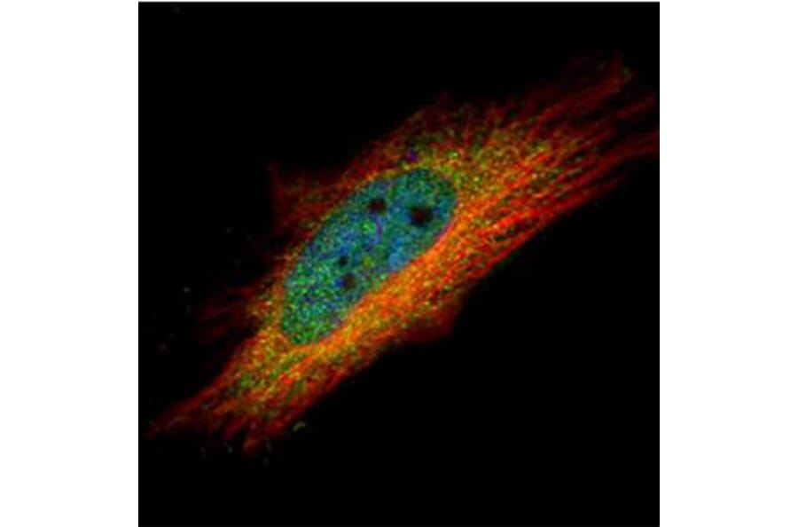 IP6K1 antibody from Signalway Antibody (22254) - Antibodies.com
