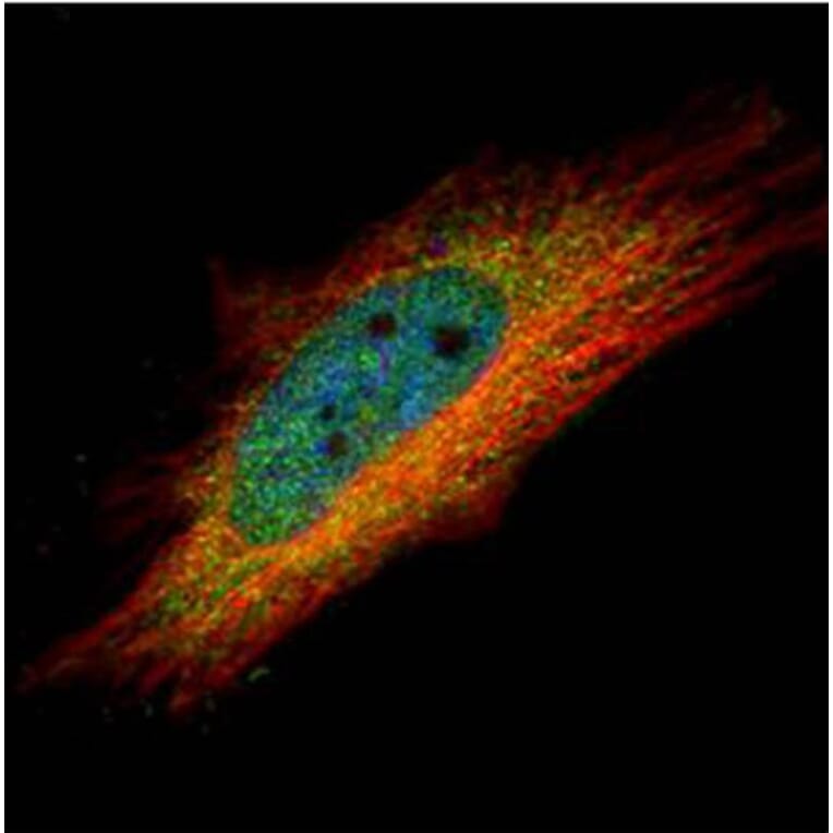 IP6K1 antibody from Signalway Antibody (22254) - Antibodies.com
