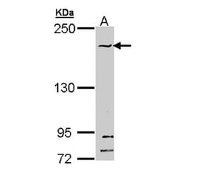 SMC1B antibody from Signalway Antibody (22261) - Antibodies.com