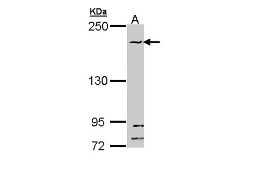 SMC1B antibody from Signalway Antibody (22261) - Antibodies.com