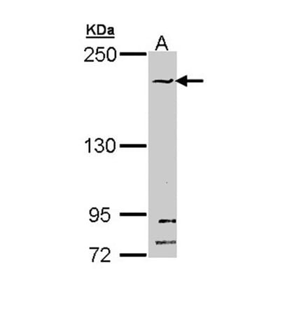SMC1B antibody from Signalway Antibody (22261) - Antibodies.com