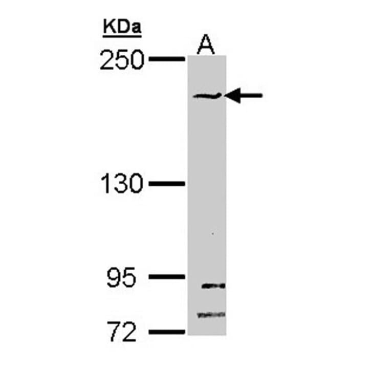 SMC1B antibody from Signalway Antibody (22261) - Antibodies.com