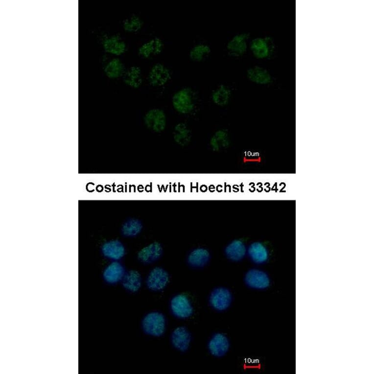 Immunofluorescence - SMC1B antibody from Signalway Antibody (22261) - Antibodies.com