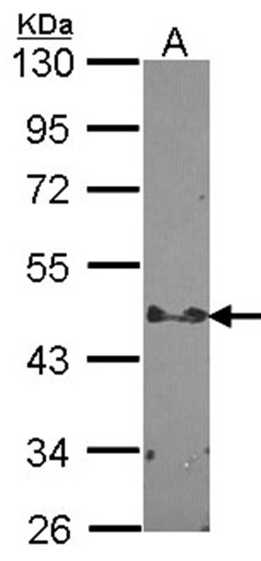 Sample (30 µg of whole cell lysate)  HCT11610% SDS PAGE Primary antibody diluted at 1: 1000