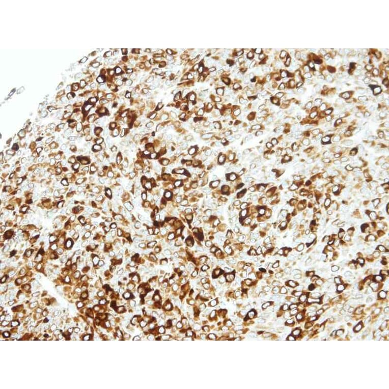 Immunohistochemistry - STAP2 antibody from Signalway Antibody (22287) - Antibodies.com